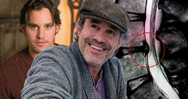 Ünlü Oyuncu Nicholas Brendon’un Ölümü Kauda Equina Sendromunu Gündeme Getirdi