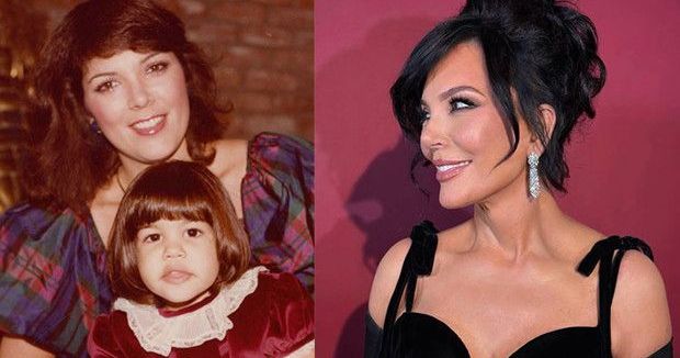 Kris Jenner, 100 Bin Dolarlık Estetik Operasyon Sonrası Yüzündeki Sorunlar Nedeniyle Düzeltme İstiyor