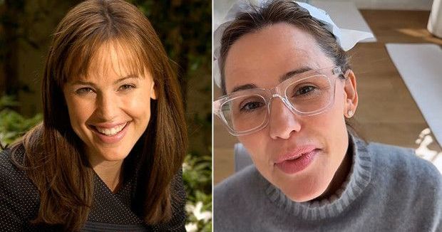 Jennifer Garner Estetik Konusunda Açık Konuştu: Çocukları Yüzüne Dokunmamasını İstiyor