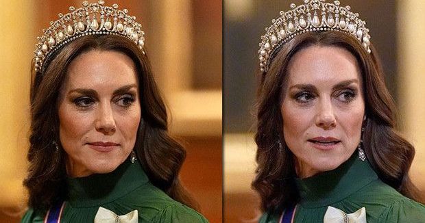 Kate Middleton, Doğal Güzelliğini Korumak İçin ‘Şişelenmiş’ Botoksa Yöneldi