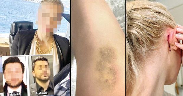 Ünlülerin Avukatına Fiziksel Saldırı Gerçekleşti